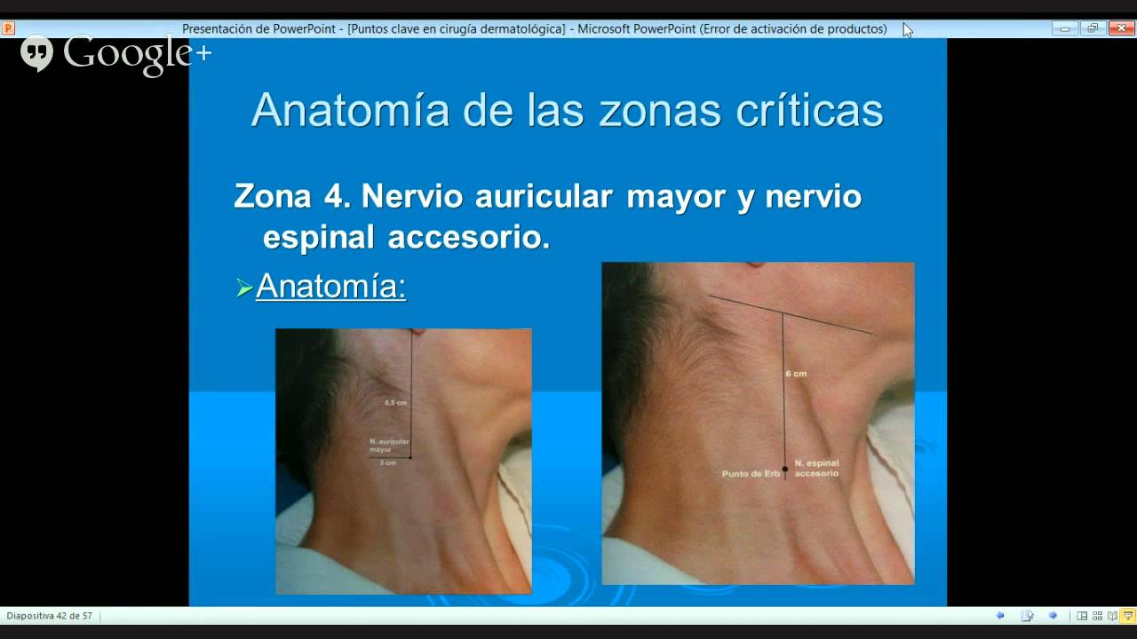 PUNTOS CLAVES EN CIRUGIA DERMATOLOGICA/KEYPOINTS IN DERMATOLOGIC SURGERY
