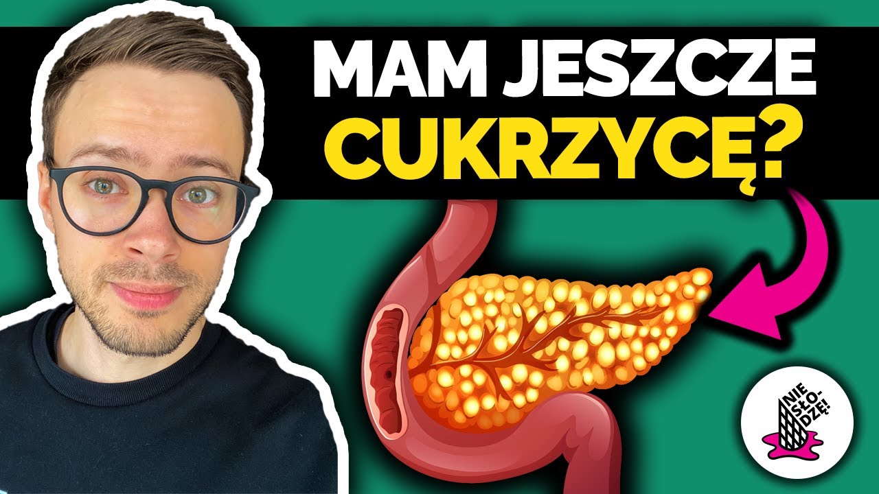 Nowoczesne leczenie CUKRZYCY TYPU 1 | Zamknięta pętla: pompa insulinowa + Dexcom G6 | Nie słodzę