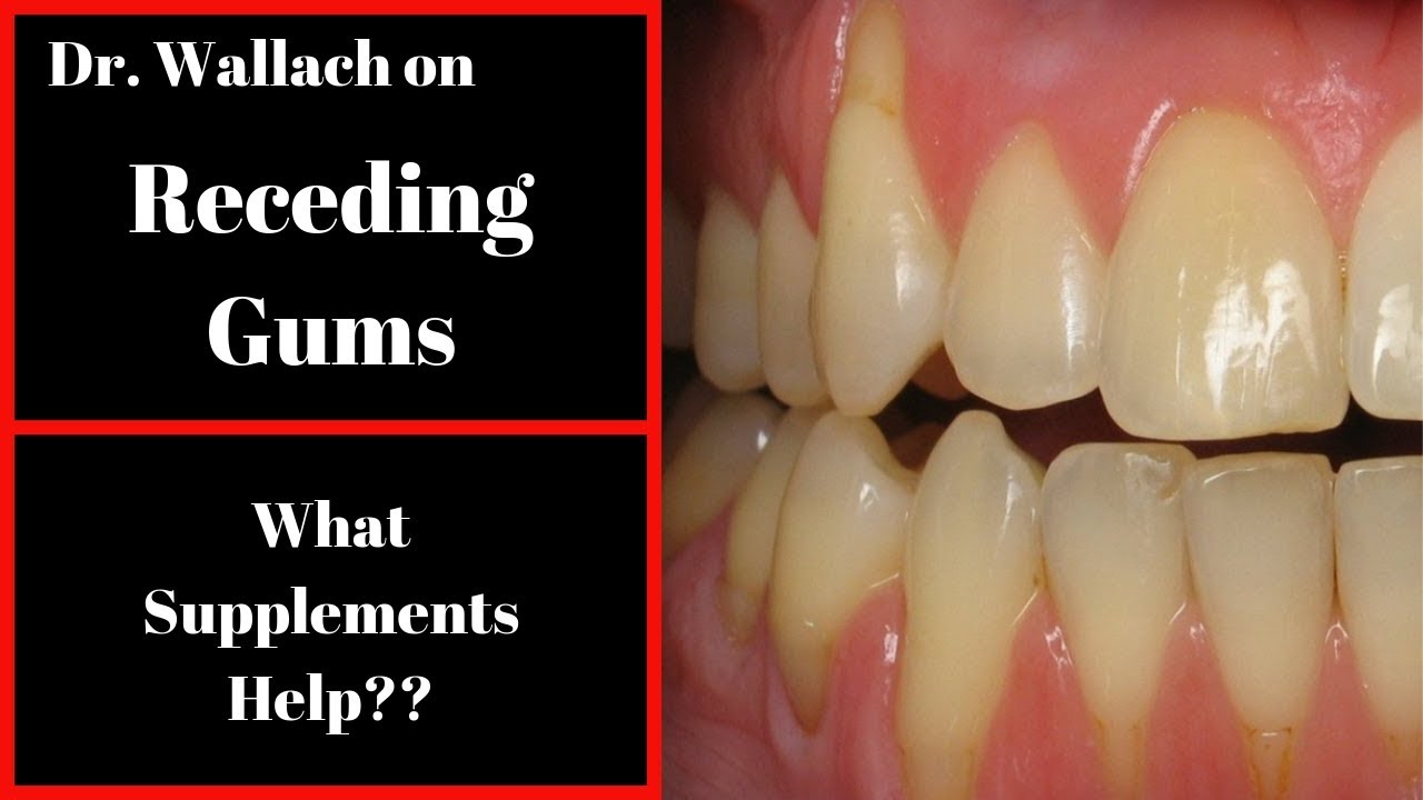Dr  Wallach on Receding Gums