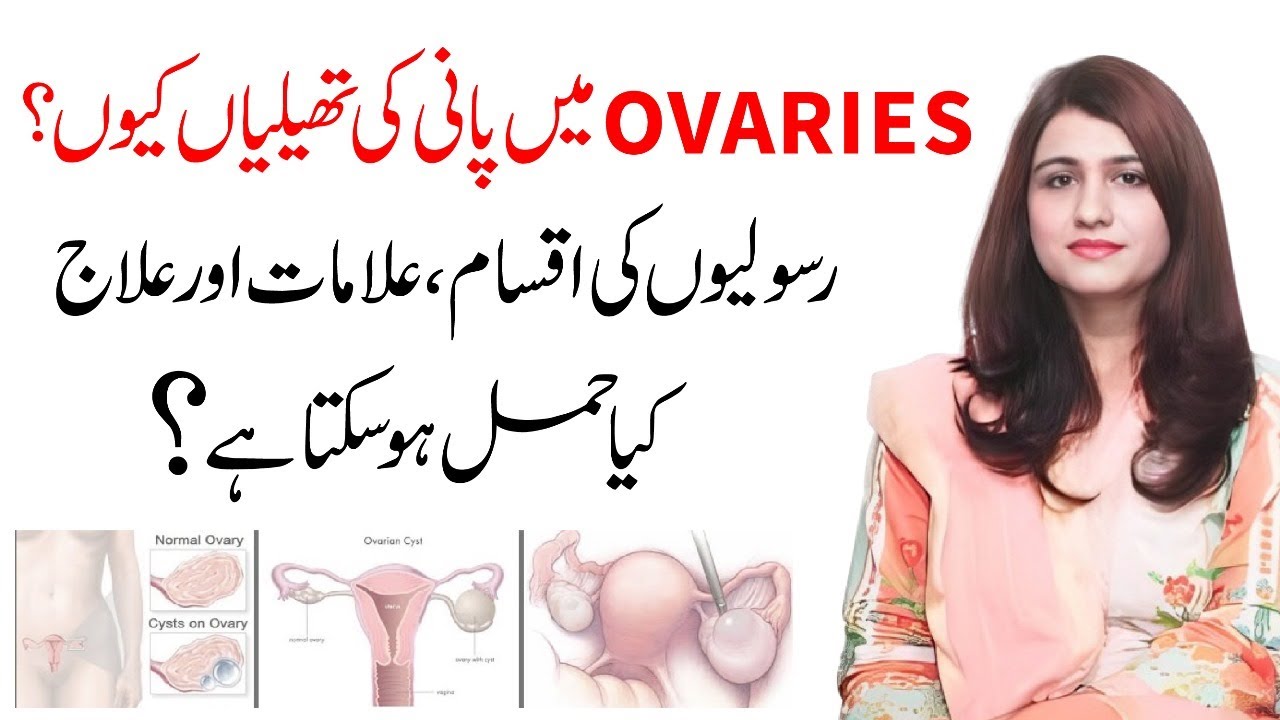 Anda Dani Ki Rasoli Ka Ilaj | Ovarian Cyst Signs And Symptoms - Dr Maryam Raana Gynaecologist