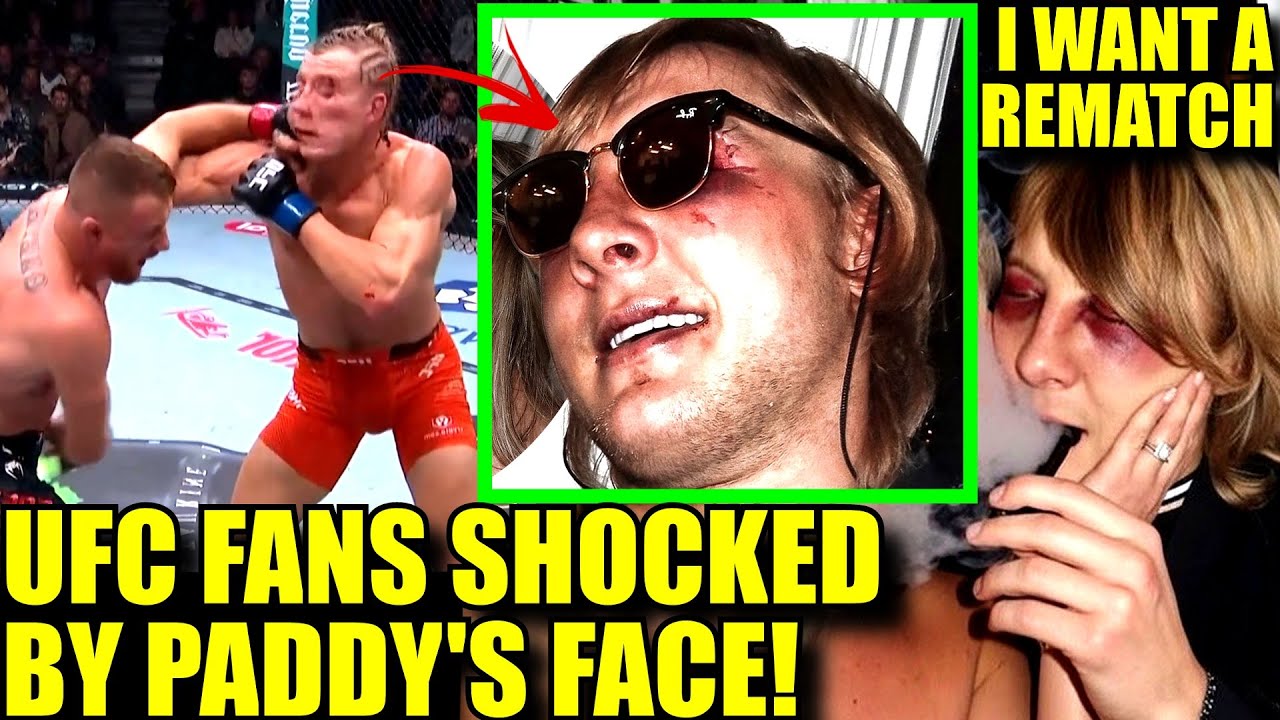 PADDY PIMBLETT&rsquo;S FACE LEFT UNRECOGNIZABLE- Wife Reveals DISTURBING Photos,Arman roasts Paddy,Conor