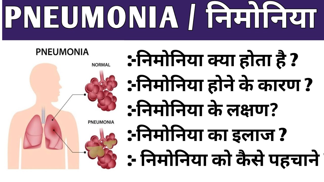 PNEUMONIA | निमोनिया | COMPLETE INFORMATION | 