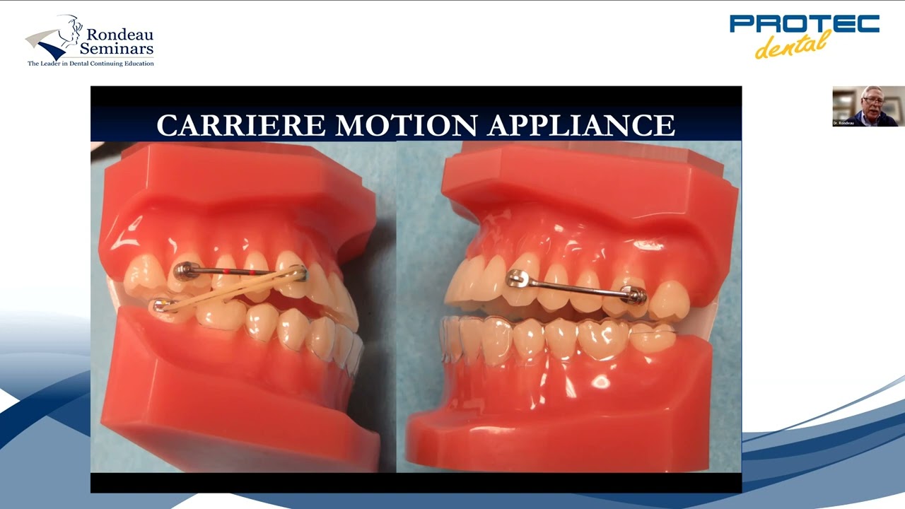 WEBINAR: Carriere Motion Appliance