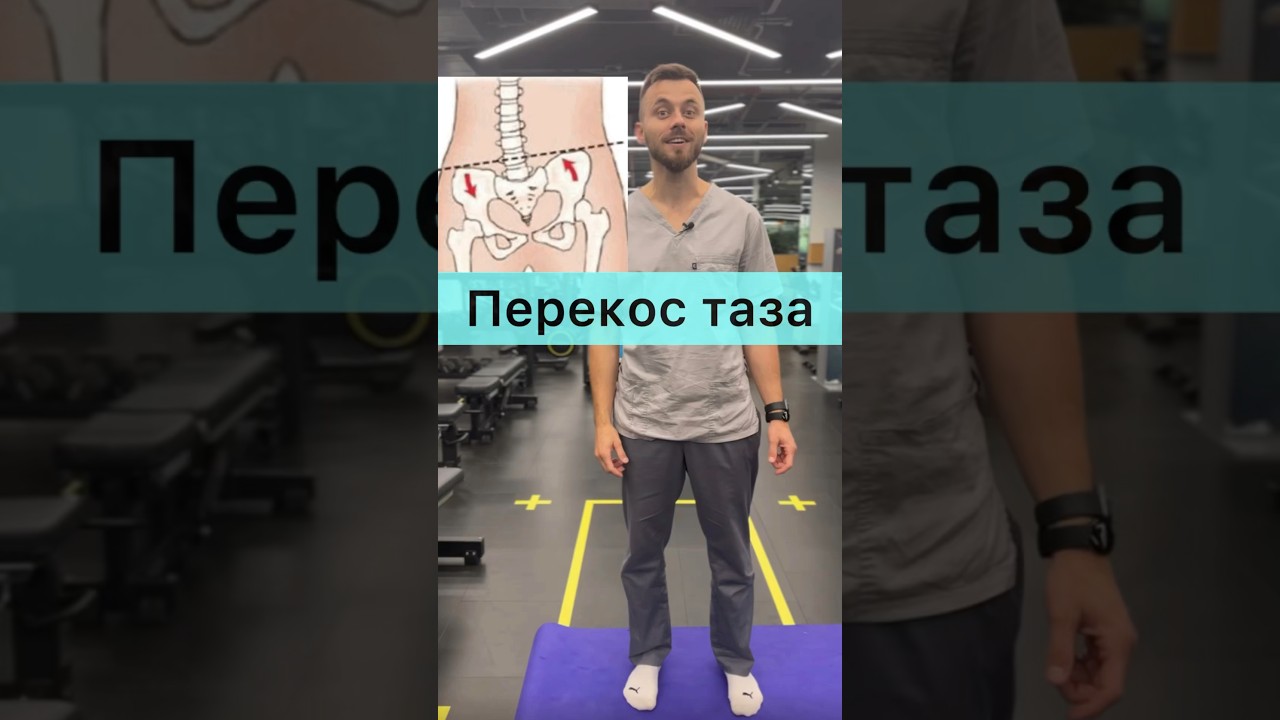 ✅ Перекос таза, комплекс упражнений