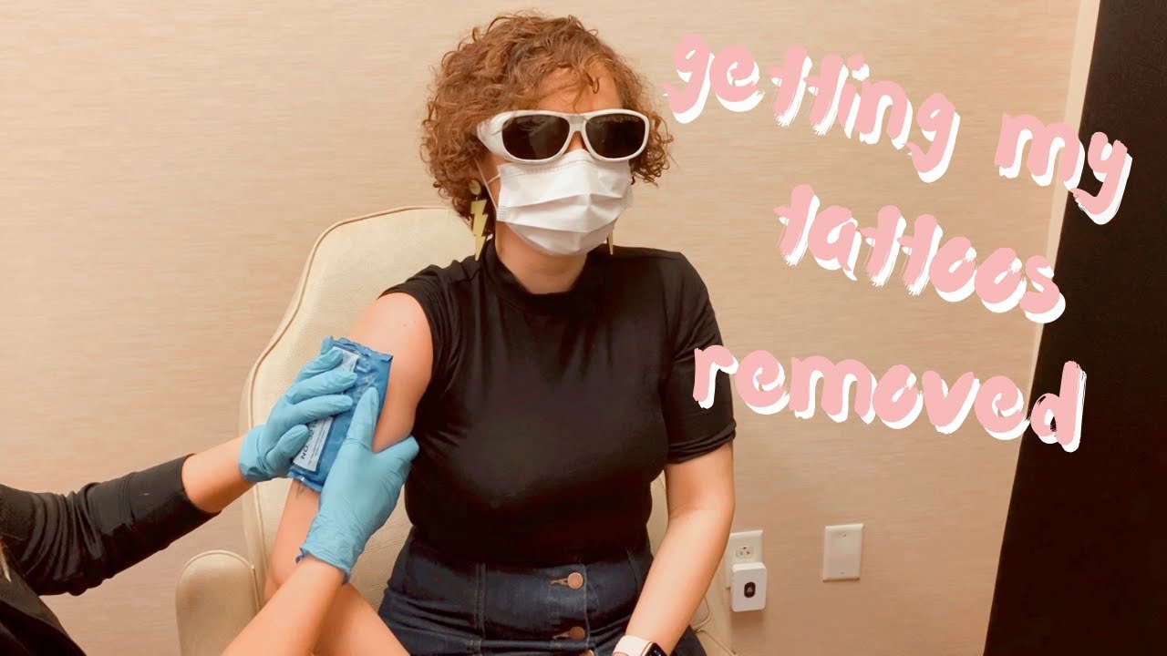 getting my tattoos removed!
