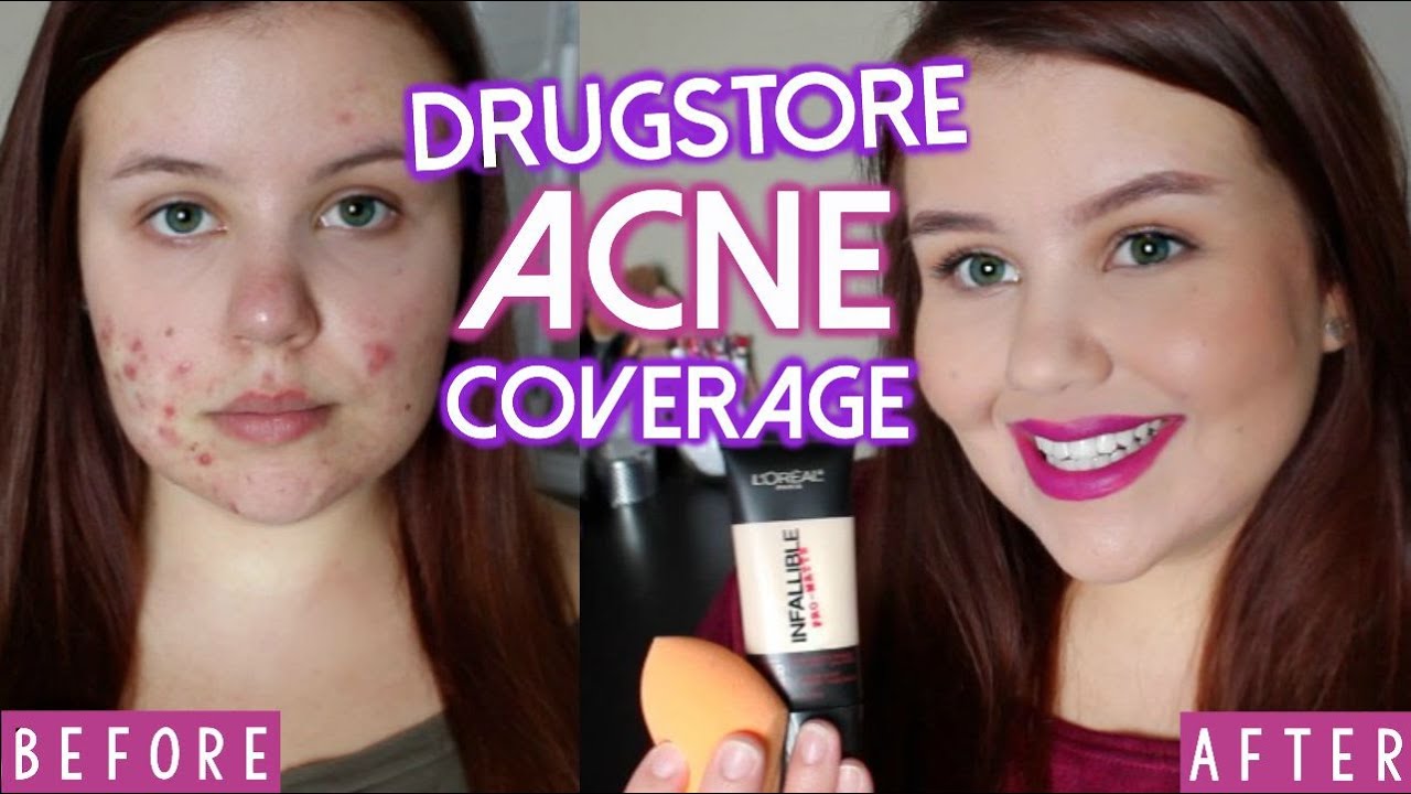 ALL DRUGSTORE Acne Coverage Foundation Routine | Cystic Acne/Scarring/Oily Skin
