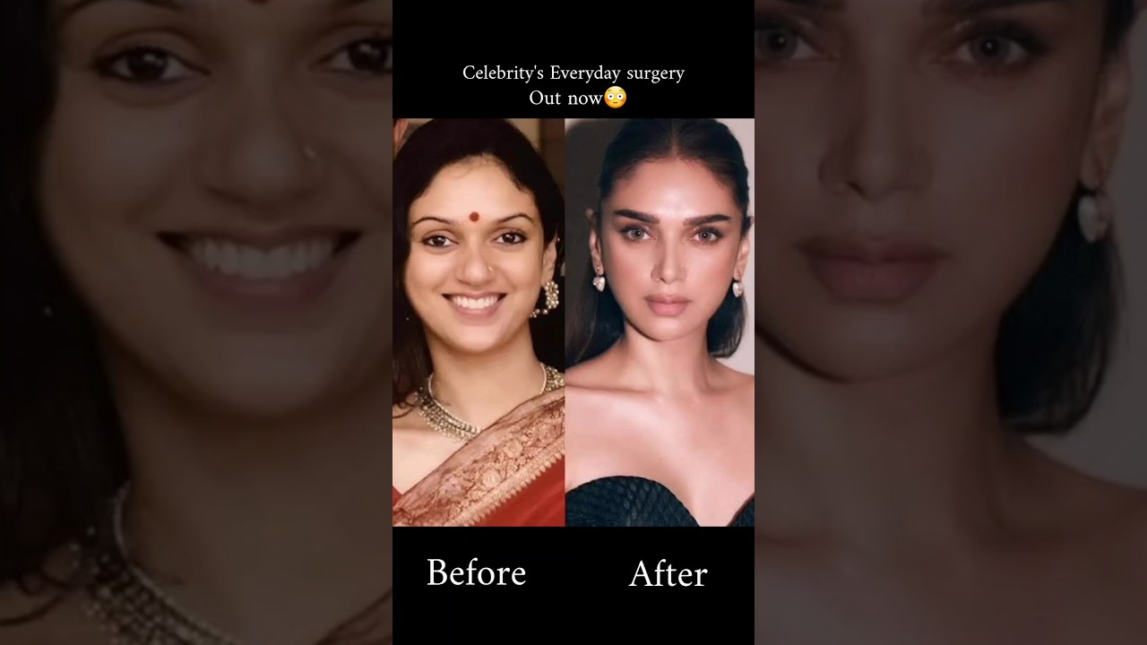 #bollywood #celebrity #beauty  #secret #transformation #health #skincare #trending #shorts