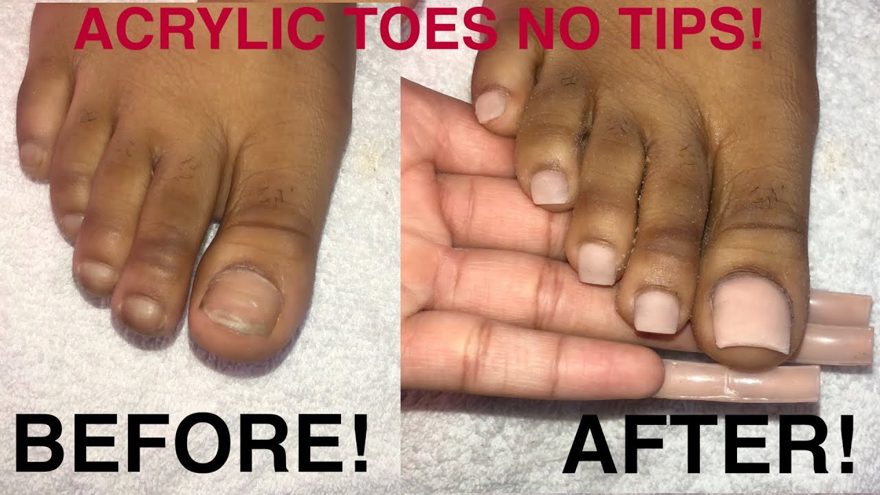 ACRYLIC TOENAILS! |NO TIPS! NATURAL OVERLAY!