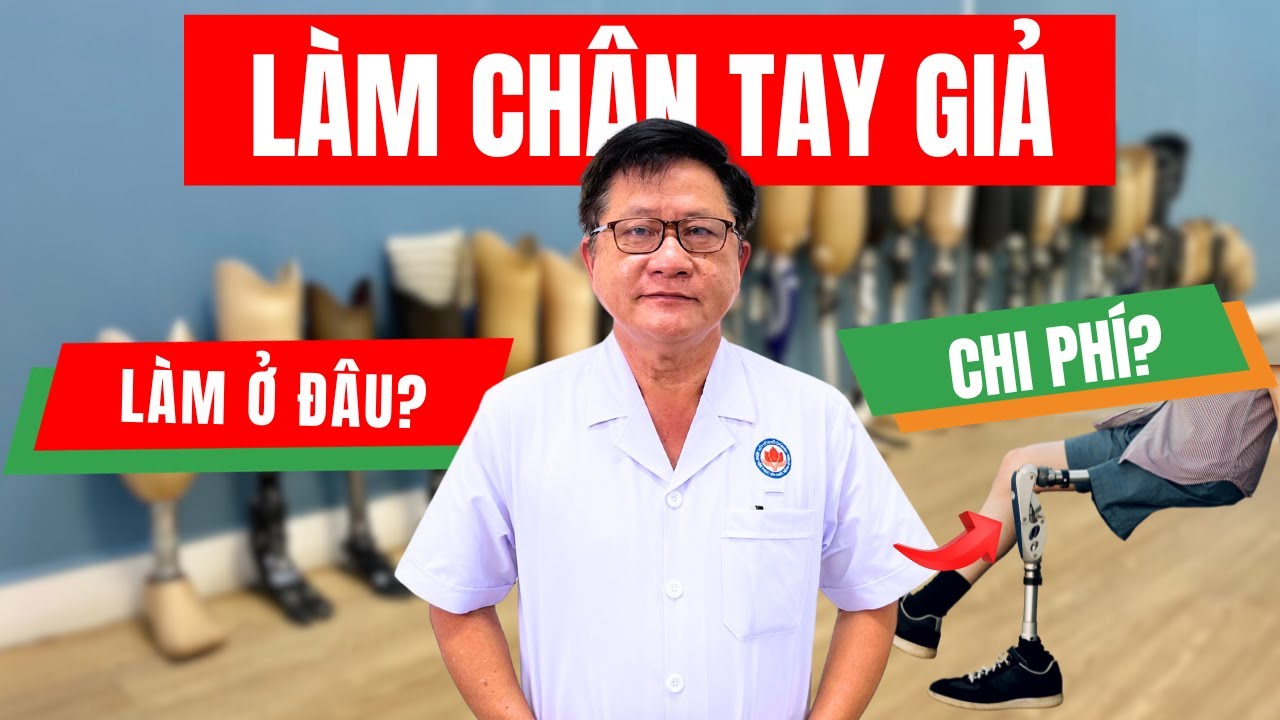 Làm Chân Tay Giả Ở Bệnh Viện Phục Hồi Chức Năng - Điều Trị Bệnh Nghề Nghiệp TPHCM Bao Nhiêu Tiền?