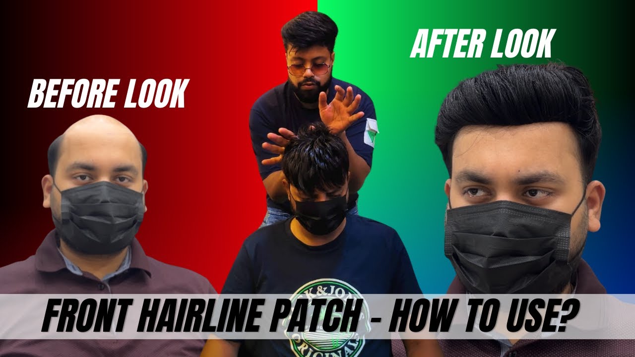 Front Hairline Patch for Men  How to Maintain, Protect & Increase Patch Life Full Guide