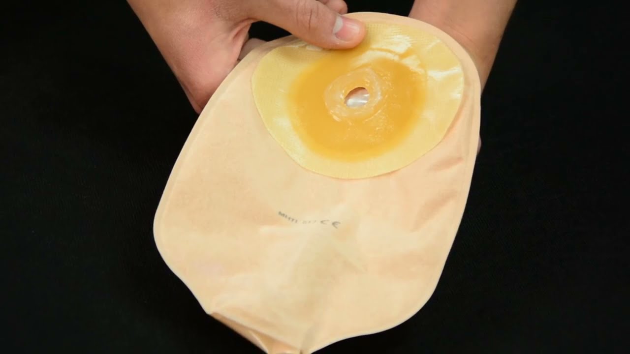 How to Apply the Silken™ Silicone Stoma Gel   Stoma Paste