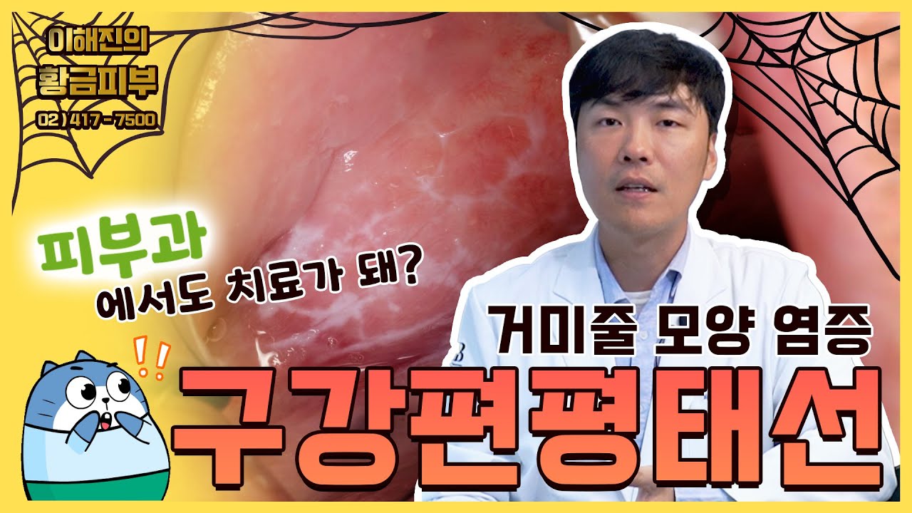 입안이 쓰라리고 이유없는 통증이 있다면 구강편평태선을 의심해봐야 합니다 / 연세에이앤비 피부과 이해진원장