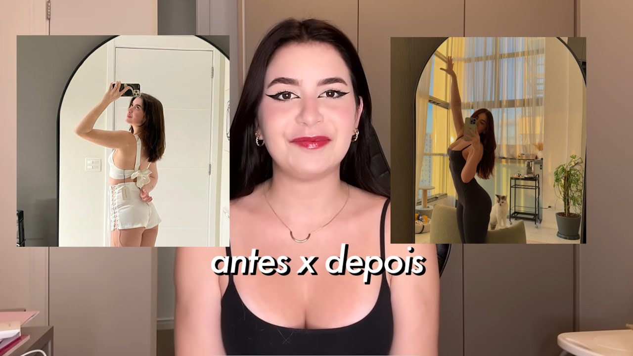 TODAS AS MINHAS CIRURGIAS