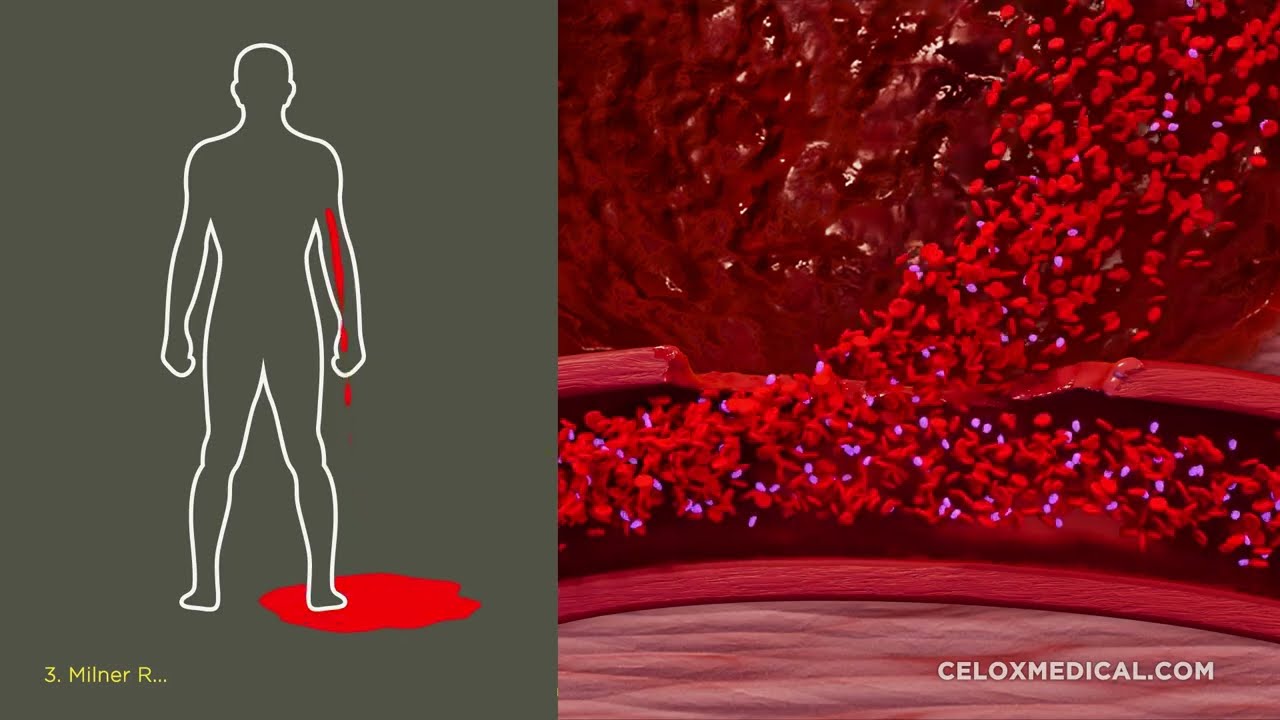 CELOX Rapid & CELOX Gauze Mode of Action Video