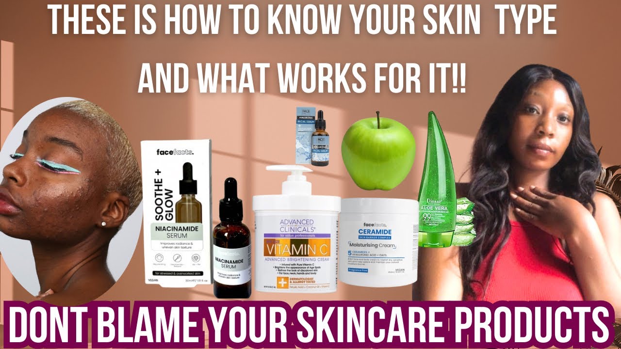 DON’T BLAME YOUR SKINCARE PRODUCT, SEE HOW TO KNOW YOUR SKIN TYPE, OILY SKIN, DRY SKIN, ACNEPRONE 