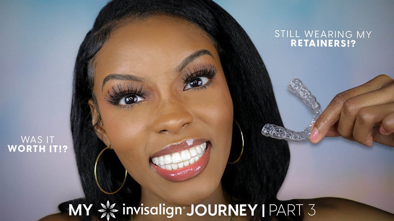 Мой путь к Invisalign | ЧАСТЬ 3: Закончили? Все еще носите ретейнеры?