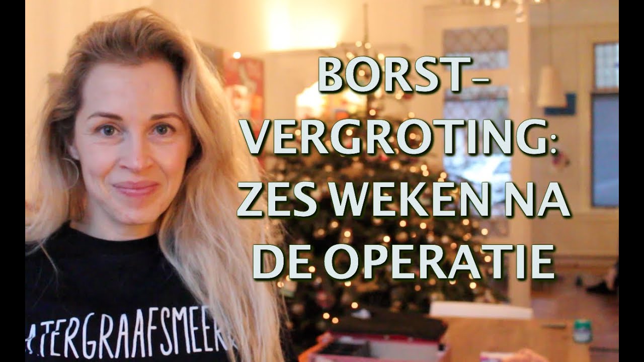 Borstvergroting: 6 weken na de operatie | FURROW.NL