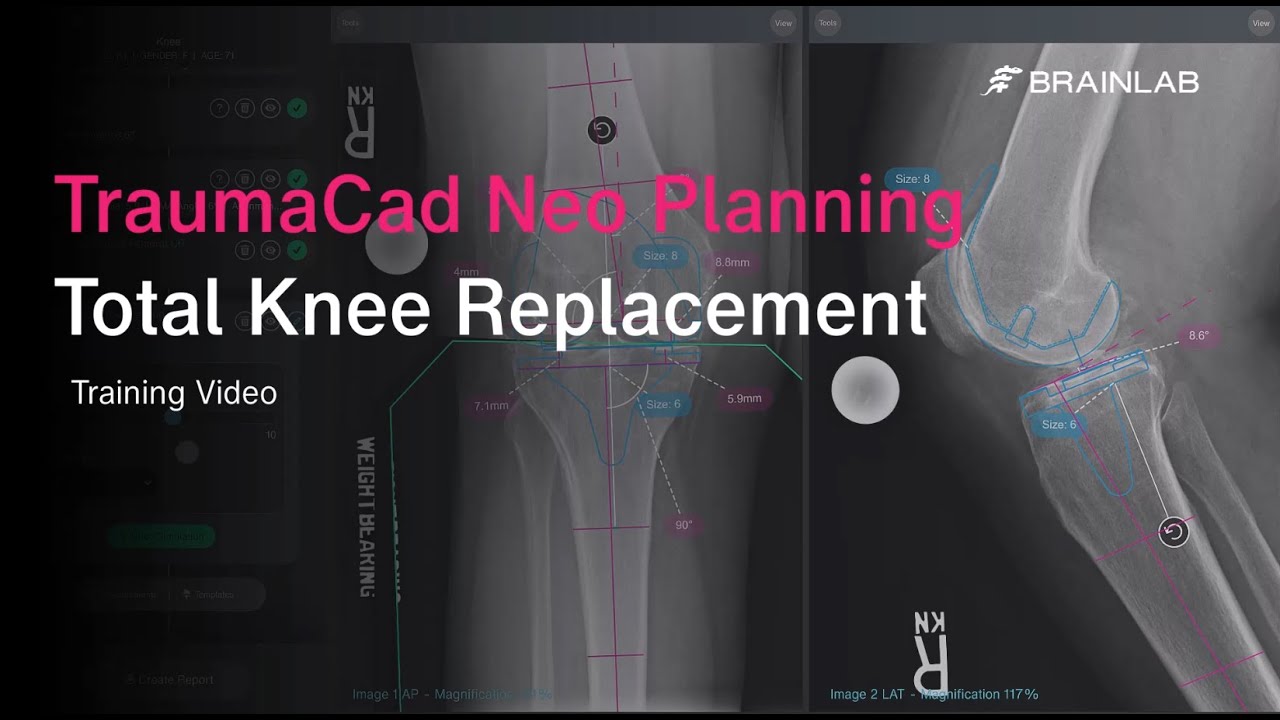 TraumaCad Neo - Knee Tutorial