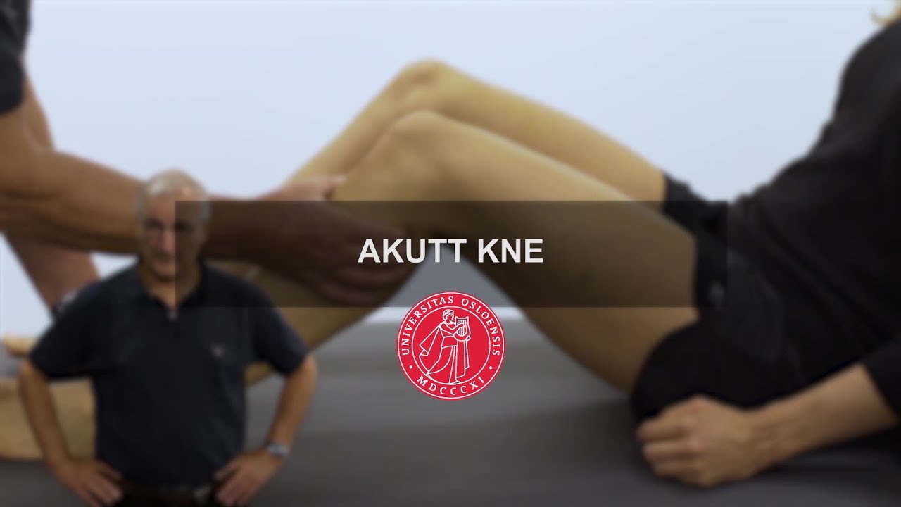 Akutt kne