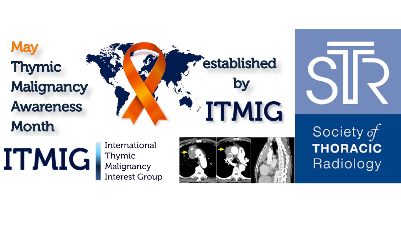 Joint STR/ITMIG Thymic Imaging Webinar