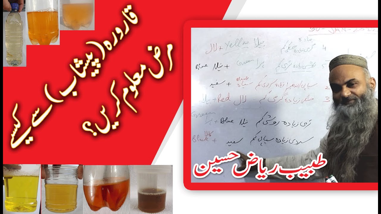 Qaroora Kesey Pehchaaney? | How to Perform Urine Test | How to recognize urine | Urdu | Hindi