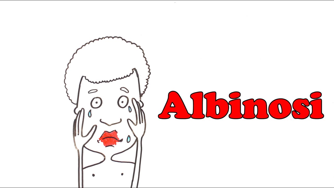 Kim są albinosi?