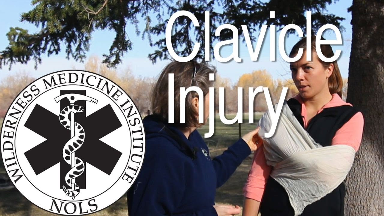 Wilderness Medicine | Clavicle Injury