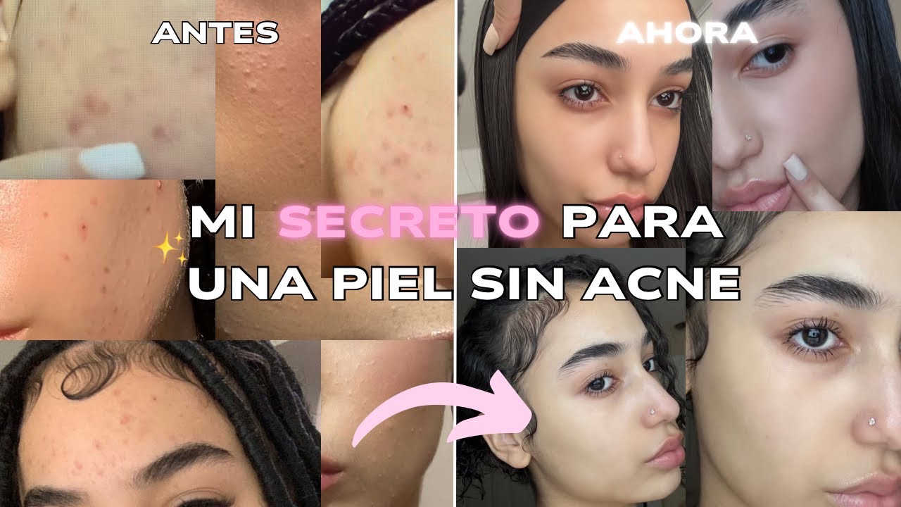 ¡El SECRETO para una PIEL PERFECTA! ✨ Mi transformación IMPACTANTE 😱 - Muñeca