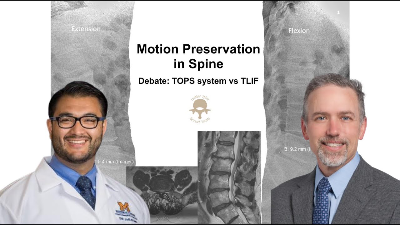 Debate: TOPS System vs TLIF