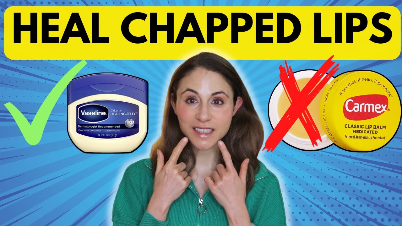 10 TIPS TO HEAL CHAPPED LIPS FAST 👄 Dermatologist @DrDrayzday