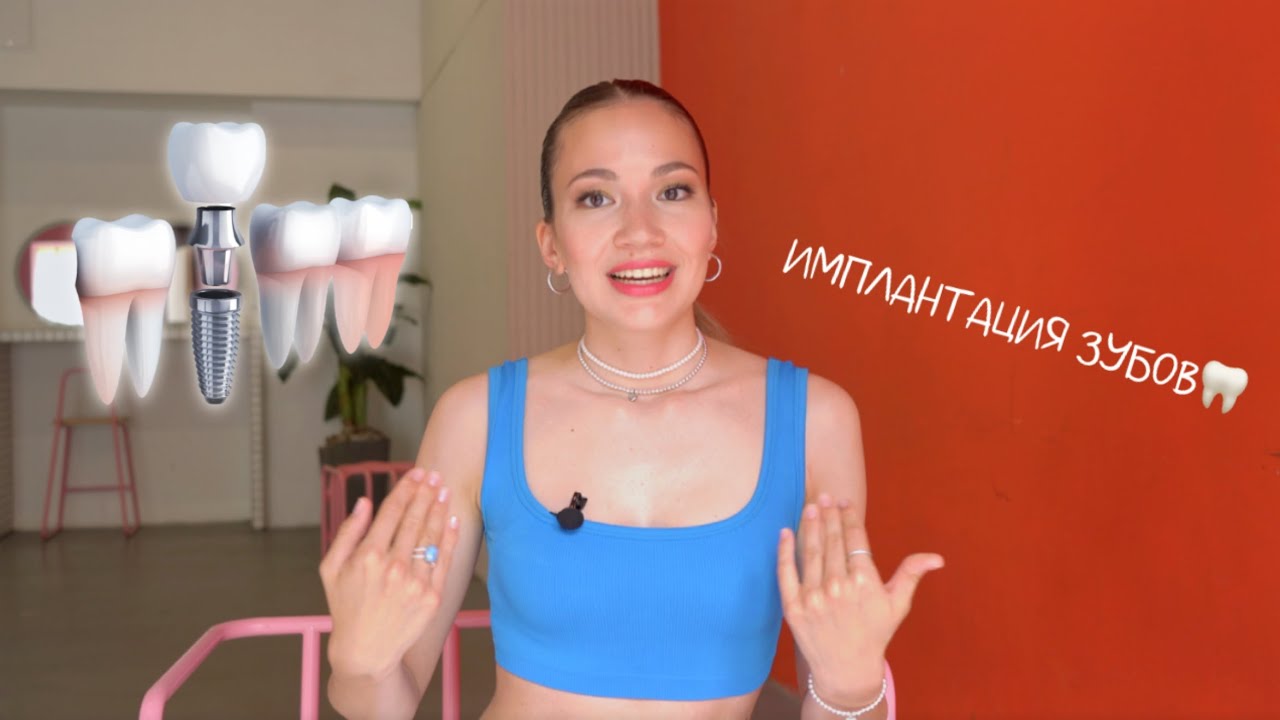 ИМПЛАНТАЦИЯ ЗУБА 🦷 МОЙ ОПЫТ 😏 НЕ ПО ПЛАНУ😂