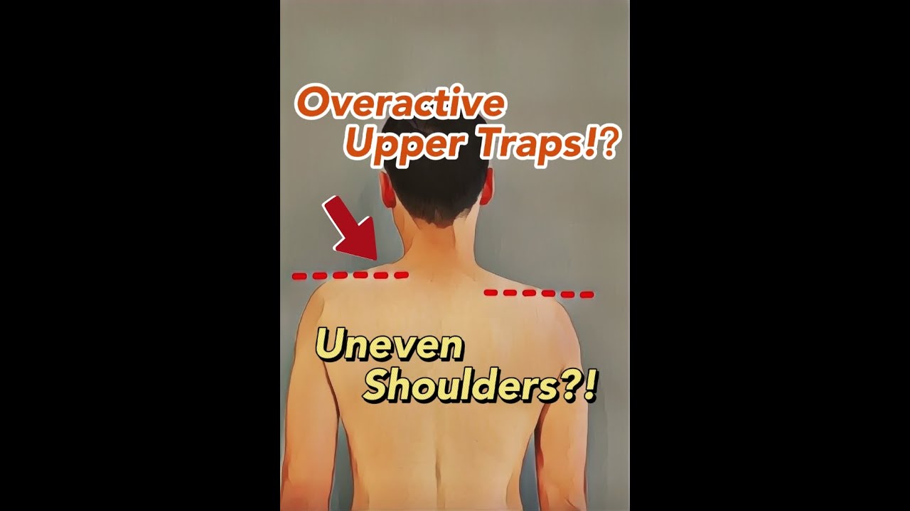 My Shoulders are Uneven! Let's talk about the Upper Traps