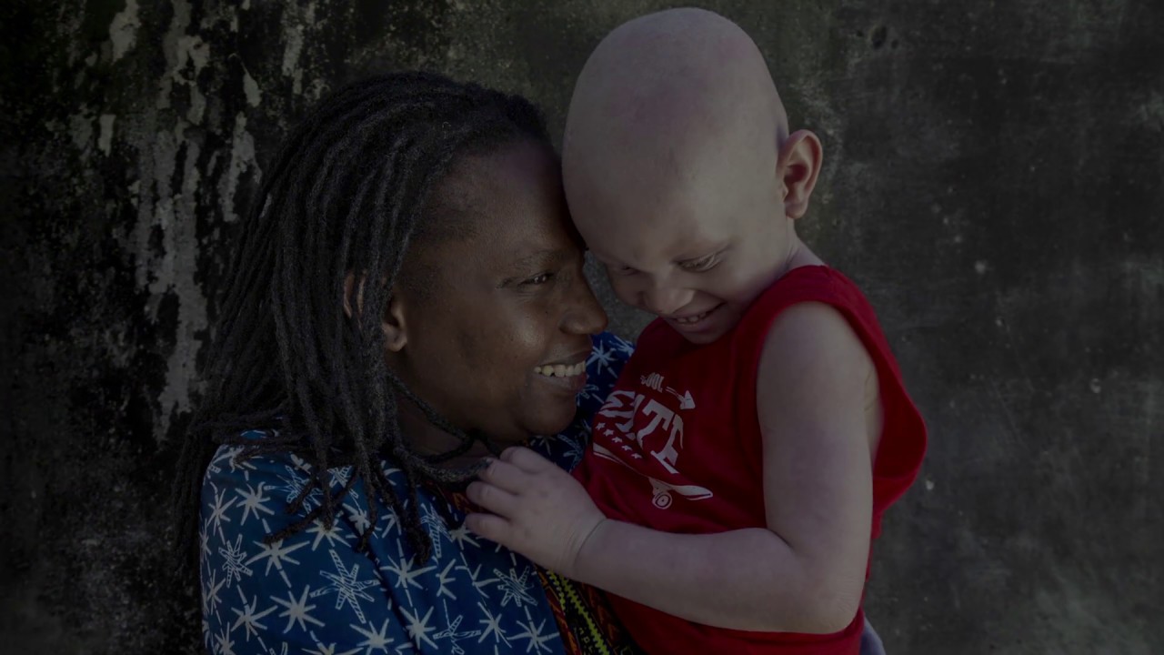 Cradle to Grave: Discrimination Against Persons with Albinism in Mozambique