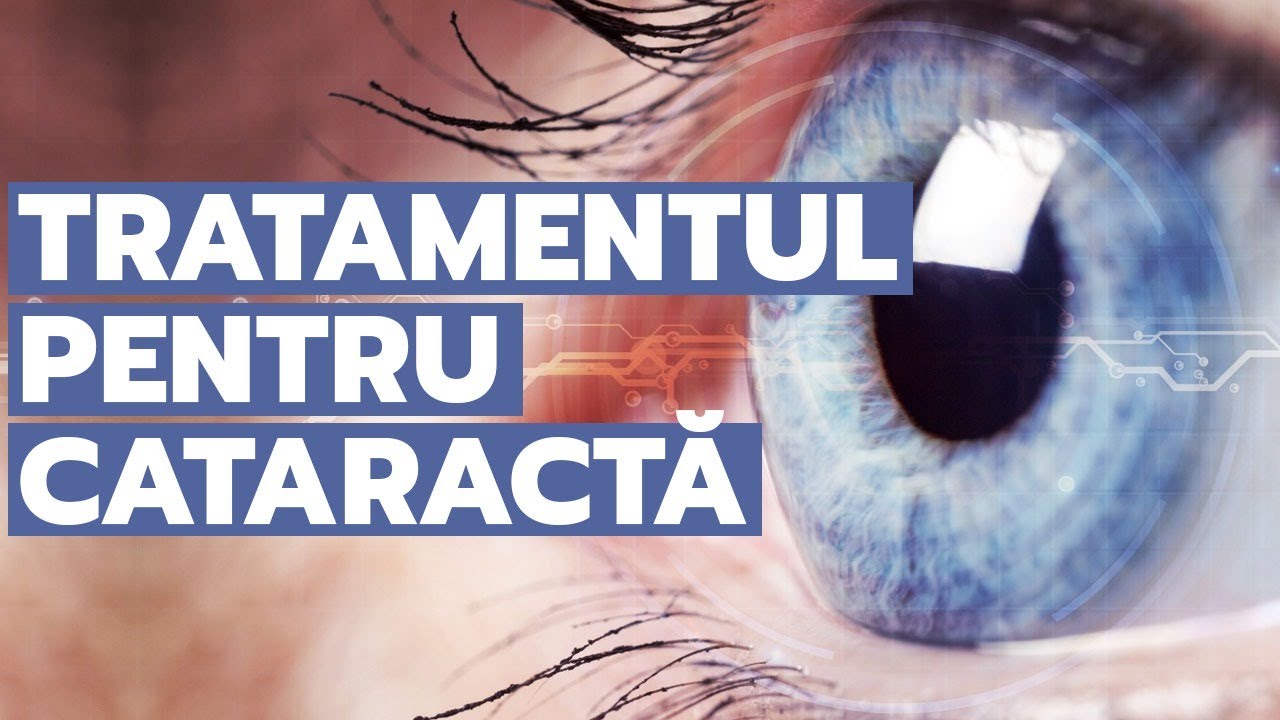 Cataracta și cristalinele de ultimă generație