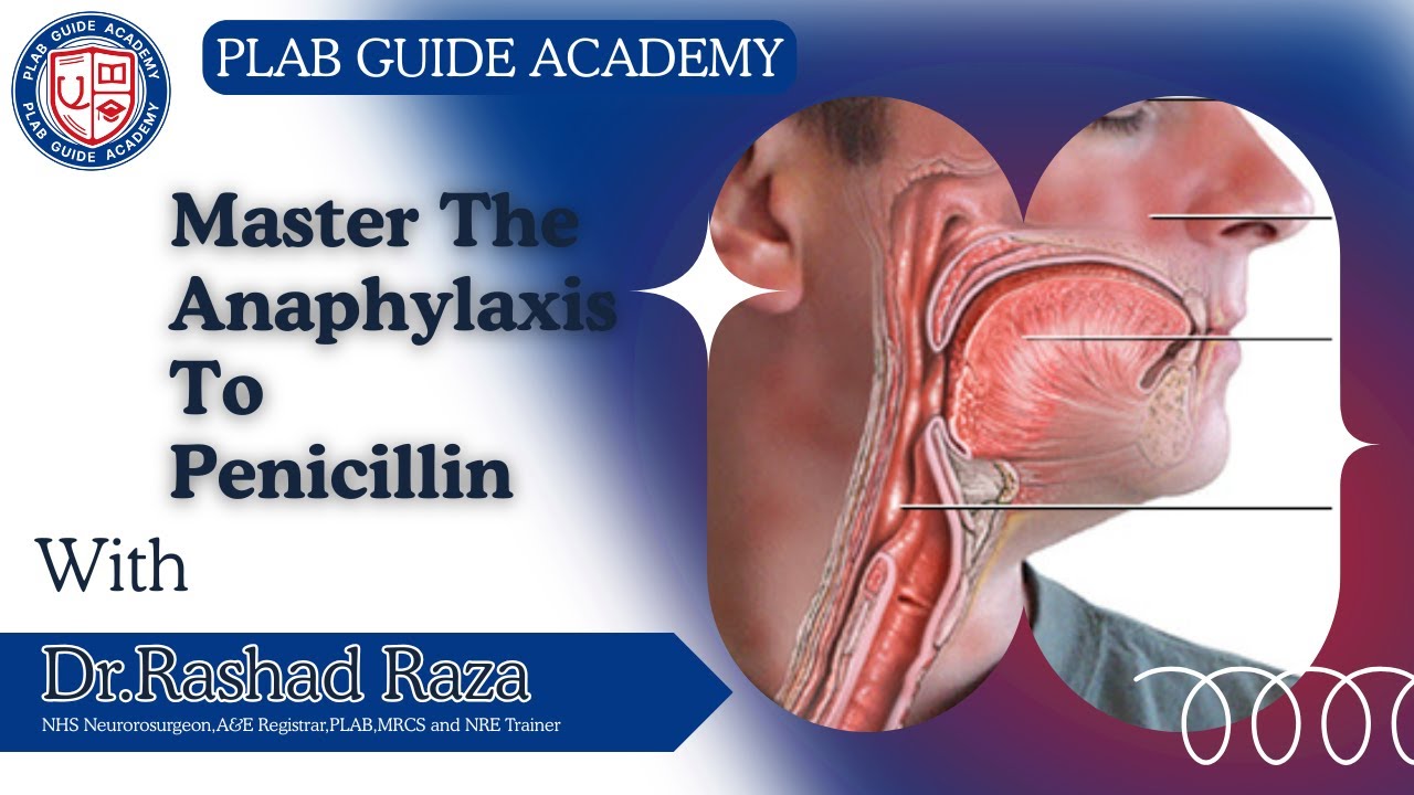 Анафилаксия на пенициллин: моделирование SIMMAN | Пошаговое руководство | PLAB GUIDE ACADEMY