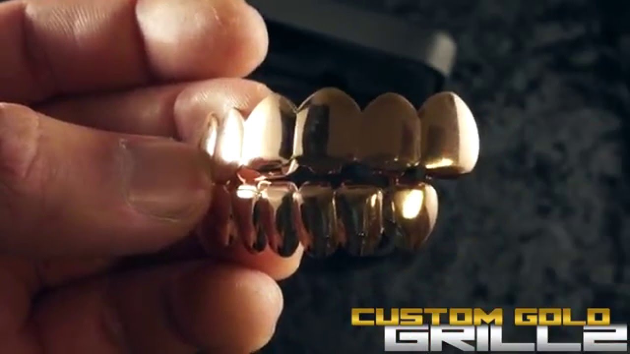 18k Rose Gold 6 Tooth Premium Grills by Custom Gold Grillz