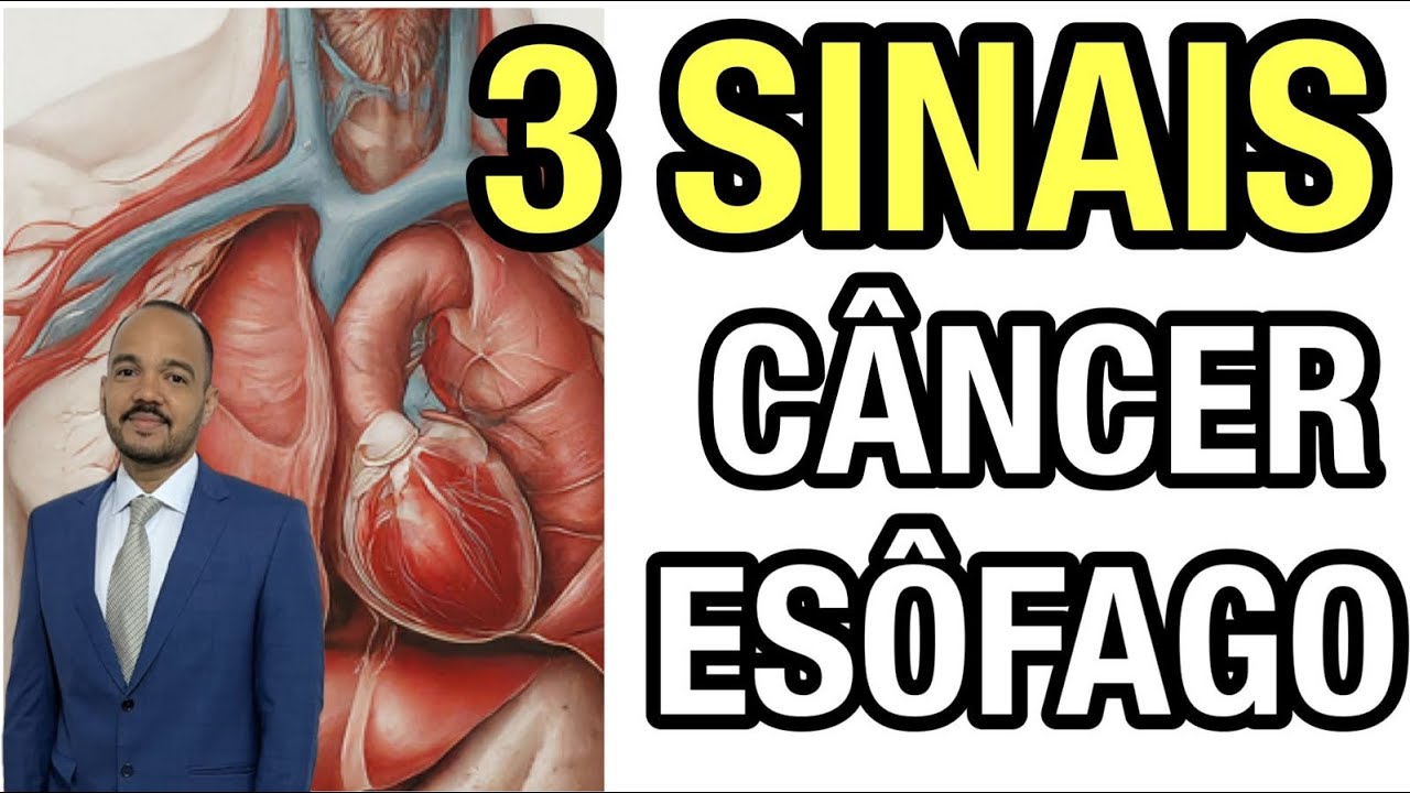 CÂNCER DE ESÔFAGO:SINAIS INICIAIS SÃO DIFÍCEIS DE IDENTIFICAR.SAIBA QUAIS SÃO !Isso pode TE SALVAR!