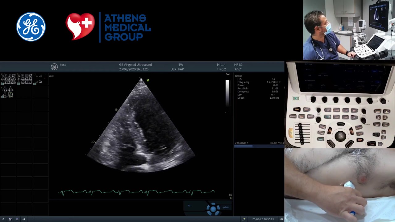 4D tutorials: 4. How to evaluate right ventricle with AutoRVQ