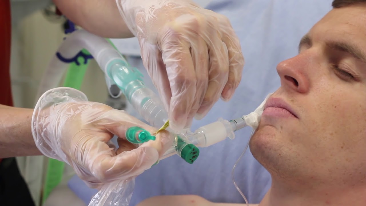 Using Intersurgical's TrachSeal™ closed suction systems