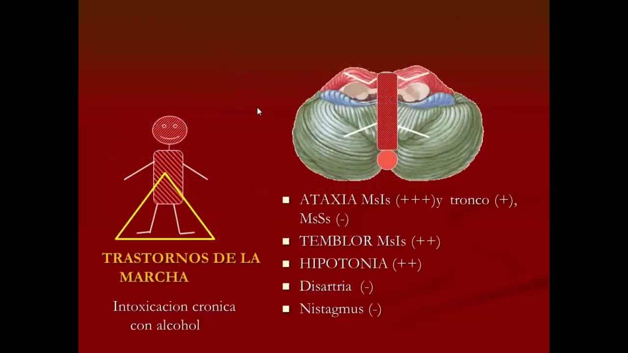 FSPTA 2025. Fisiopatologia de Sindromes Cerebelosos