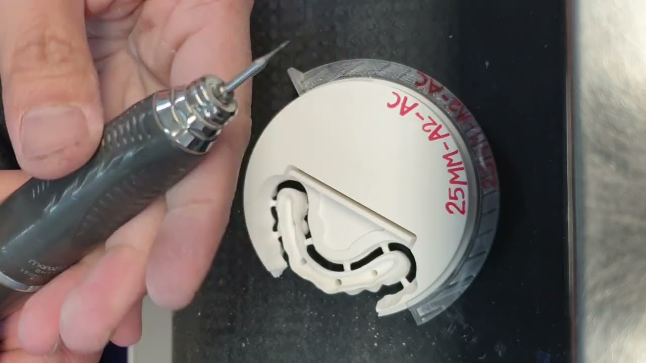 Upper & Lower Green stage zirconia bridges manual trimming 
