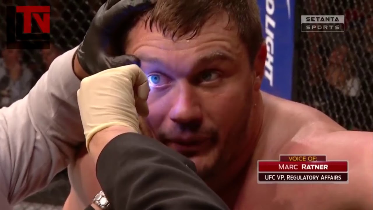 Matt Mitrione VERLUSTE im MMA-K&auml;mpfe / MEATHEAD BLUTIGEN AUGE