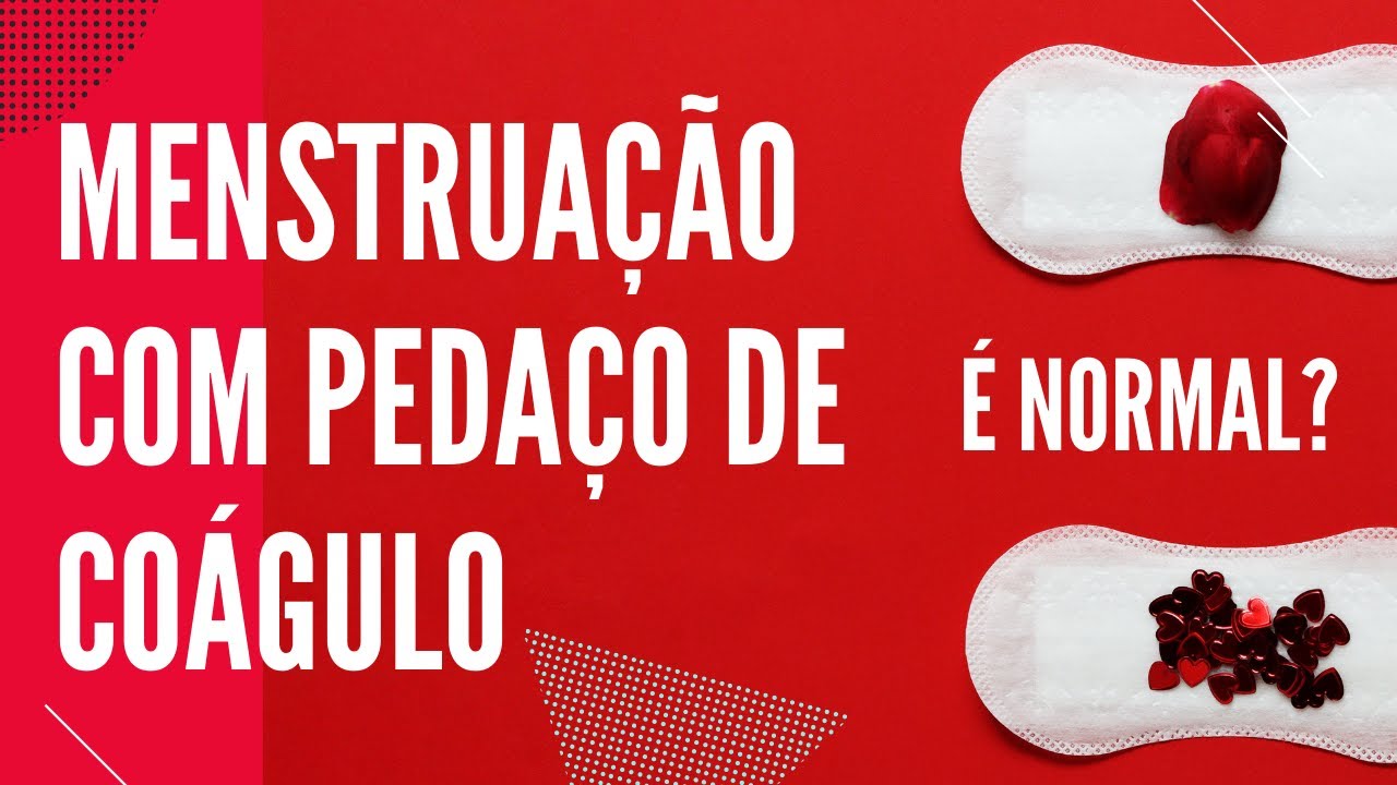 Menstruação com coágulos: 5 principais causas e o que fazer?