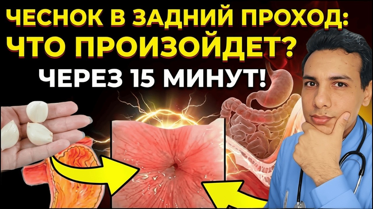 Чеснок в прямую кишку: польза или опасный миф? Врач раскрывает правду