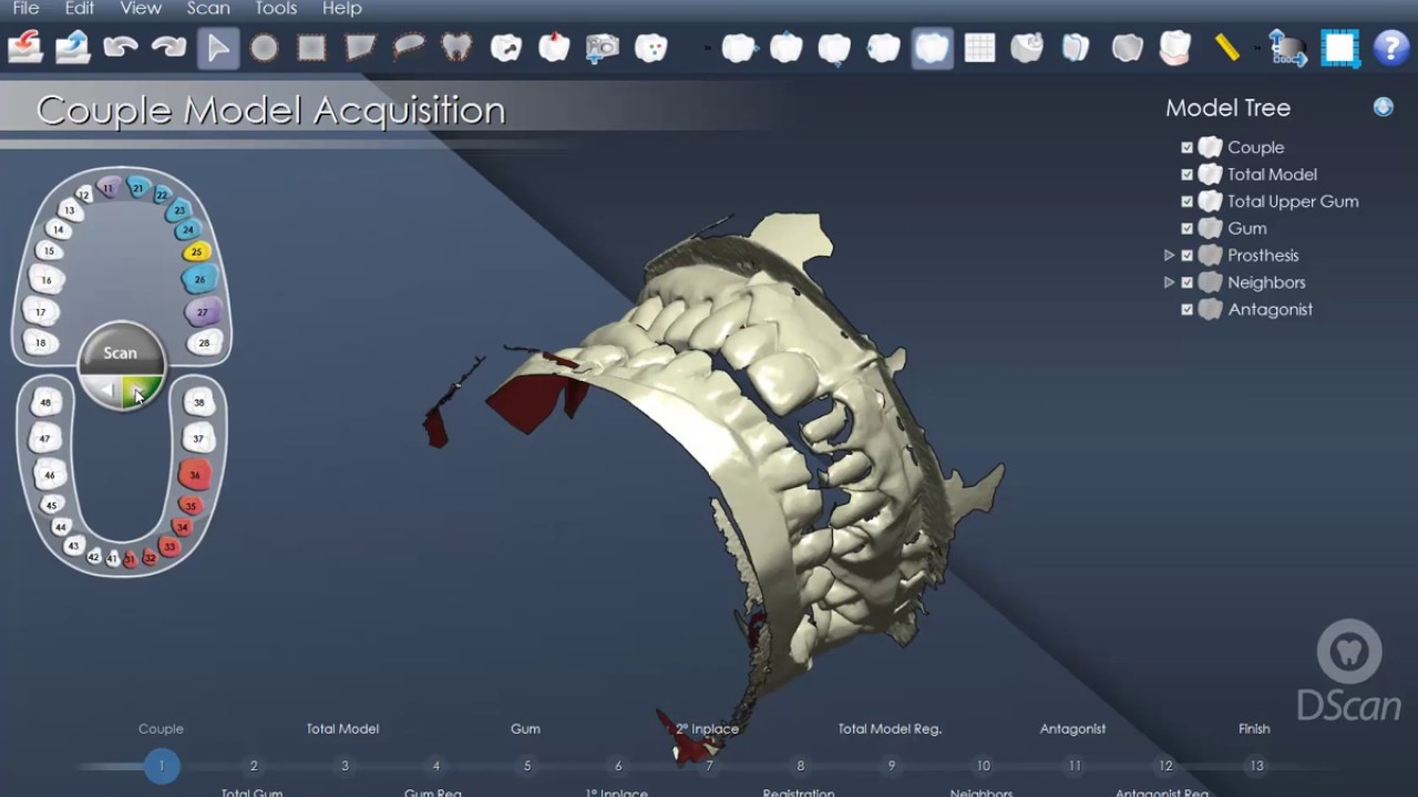 DentalCad 5.4 - Scanning cycle with antagonist for a job on upper arch