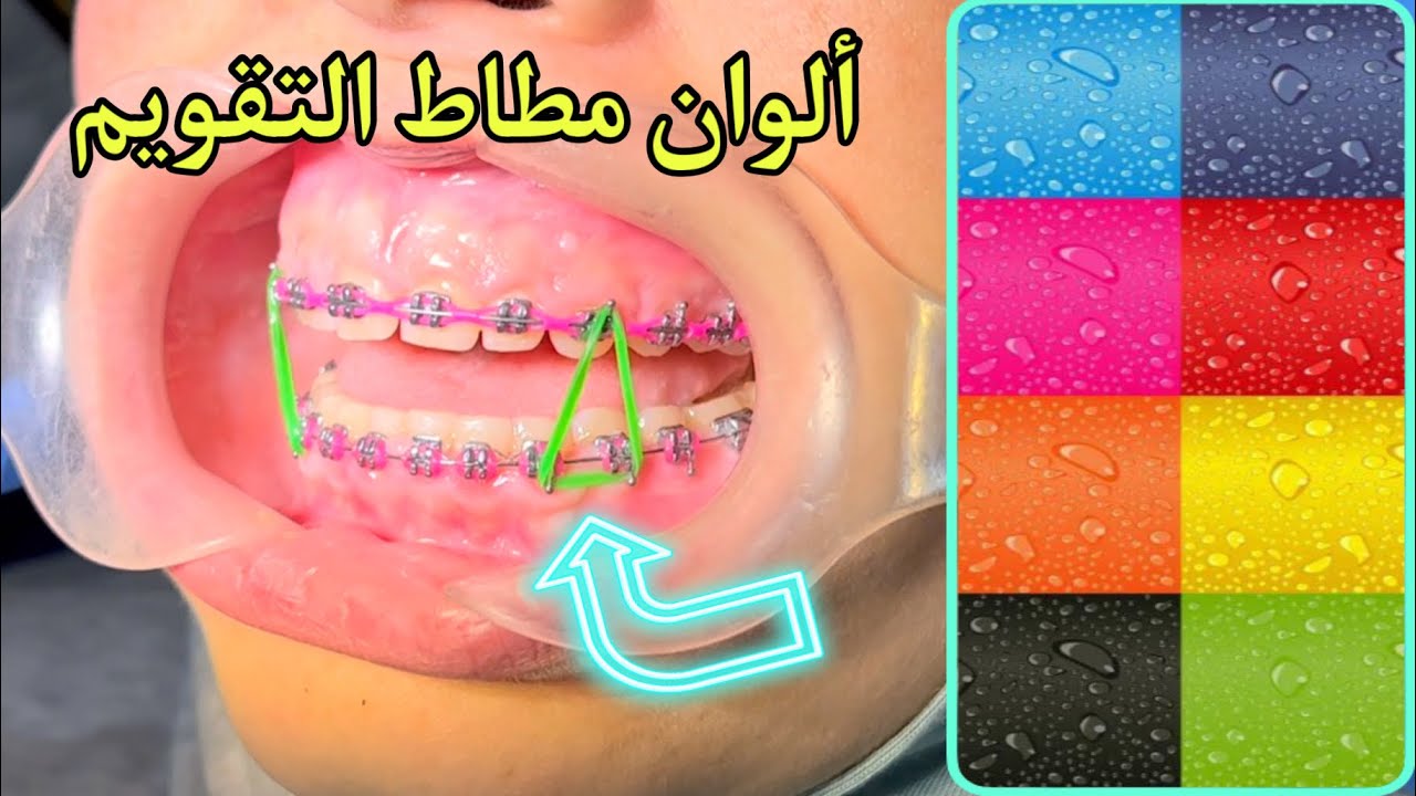مطاط التقويم { كيف ؟ متى ؟ لماذا ؟ } 