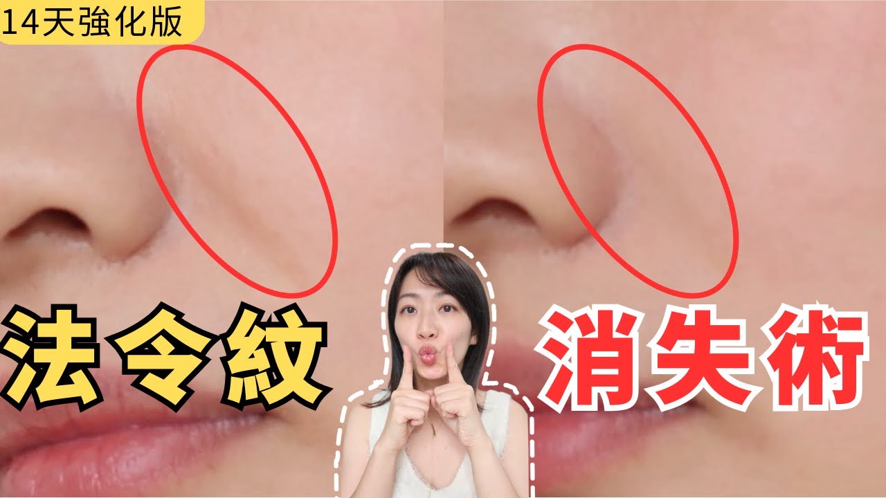 4分鐘告別法令紋｜0元快速逆齡｜美容師親授14天改善法