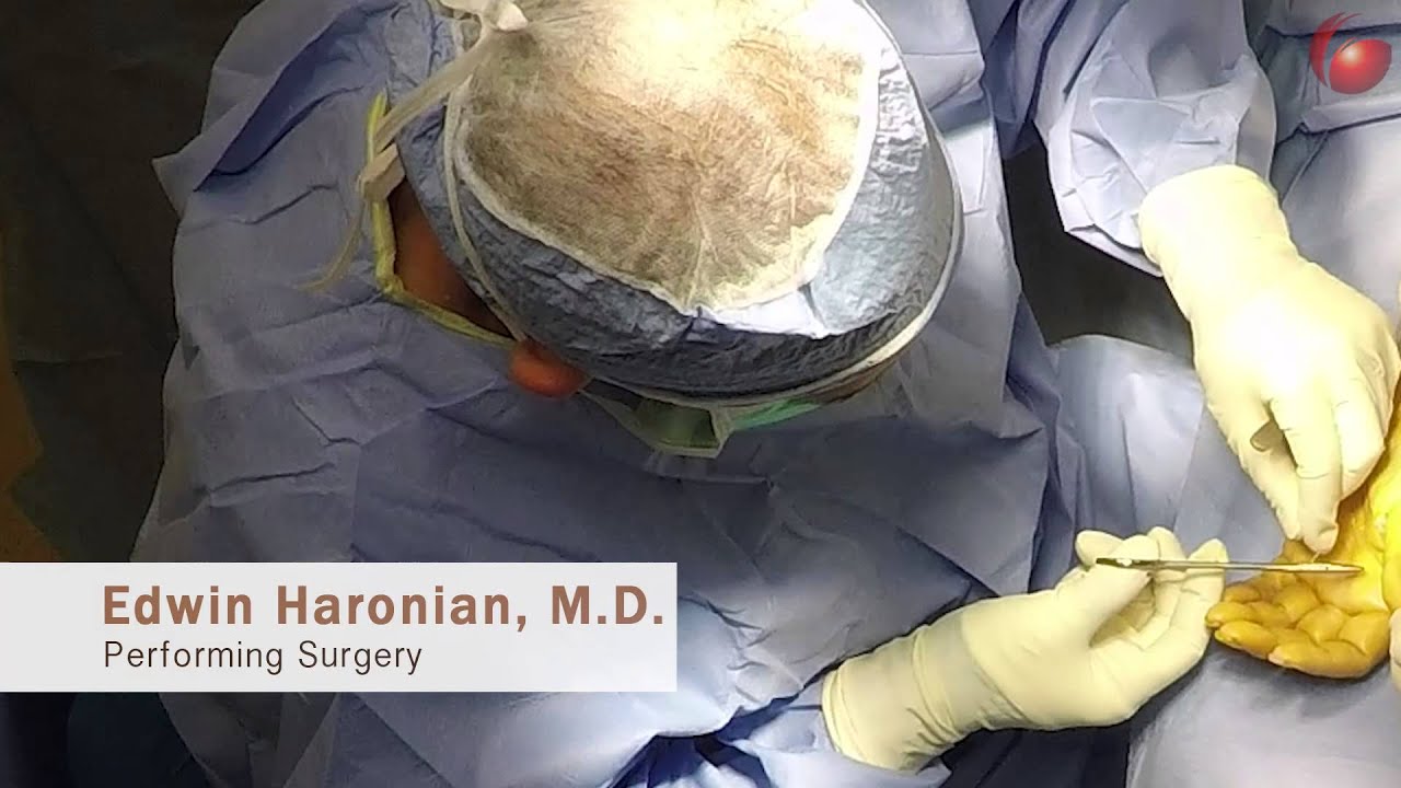 Double Carpal Tunnel Release Surgery Patient Experience
