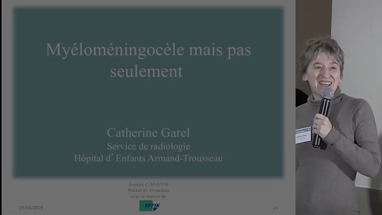 Myéloméningocèle mais pas seulement - Présentation du Dr Catherine Garel