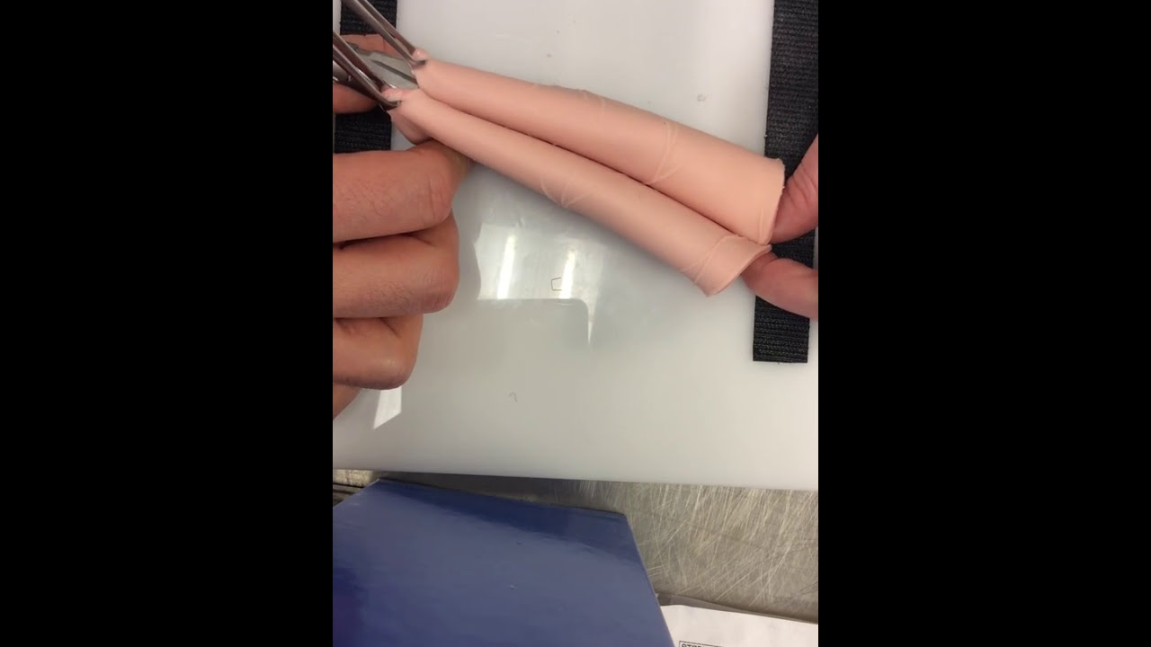 Open Stapled Side-side GI anastomosis